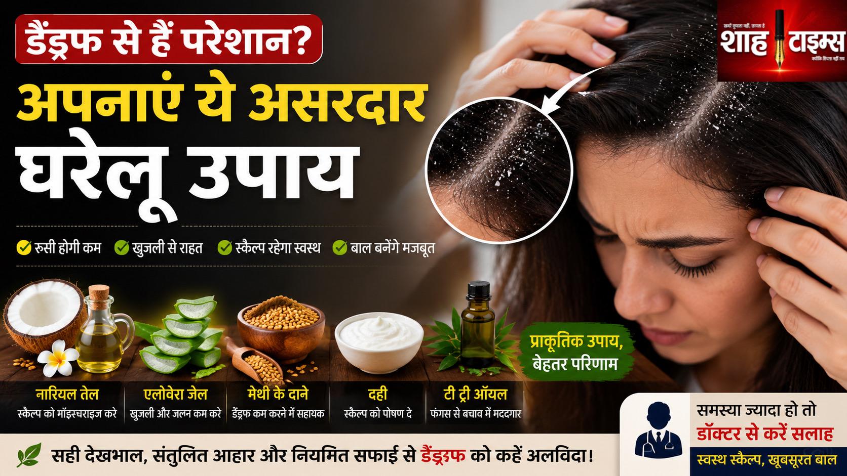 डैंड्रफ से हैं परेशान? अपनाएं ये आसान घरेलू उपाय, मिल सकती है राहत