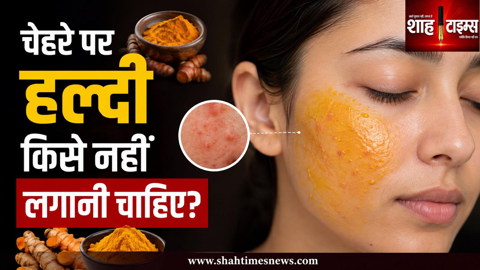 किन लोगों के लिए नुकसानदायक हो सकता है चेहरे पर हल्दी लगाना? जानिए त्वचा विशेषज्ञों की चेतावनी