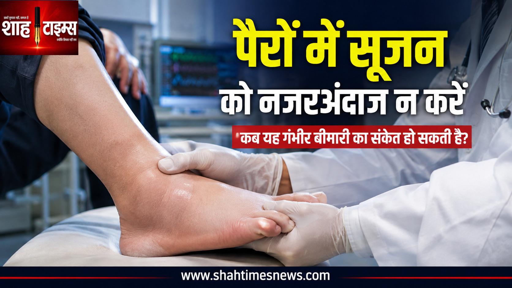 पैरों में सूजन को नजरअंदाज न करें, कब यह गंभीर बीमारी का संकेत हो सकती है?